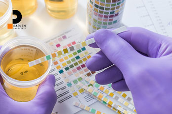 پروتئینوری