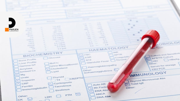 آزمایش ژنتیکی قبل از تولد