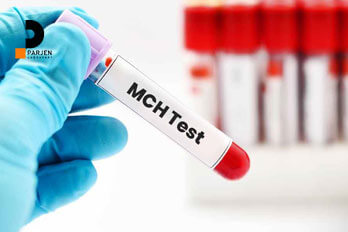 چگونه میزان MCH