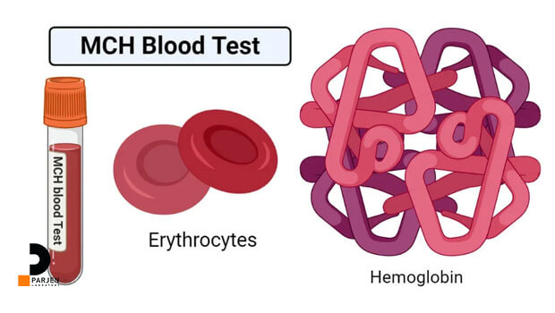 چگونه میزان MCH تعیین میشود؟
