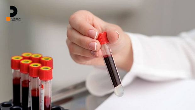 علت بالا بودن MCH در آزمایش خون