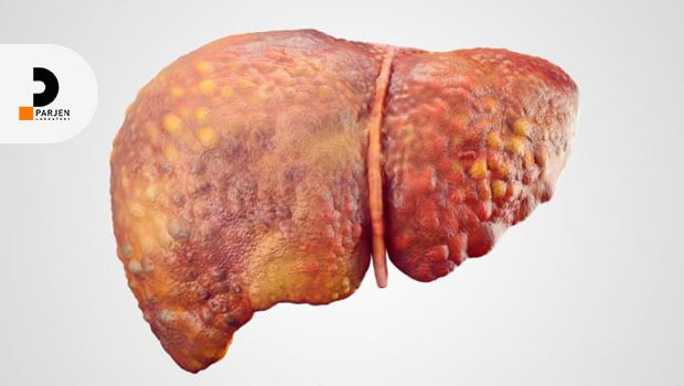 نکات کلی رژیم غذایی برای کبد چرب